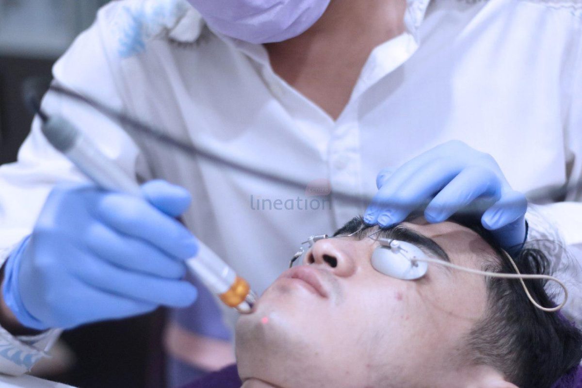 laser wajah di bandung lineation centre