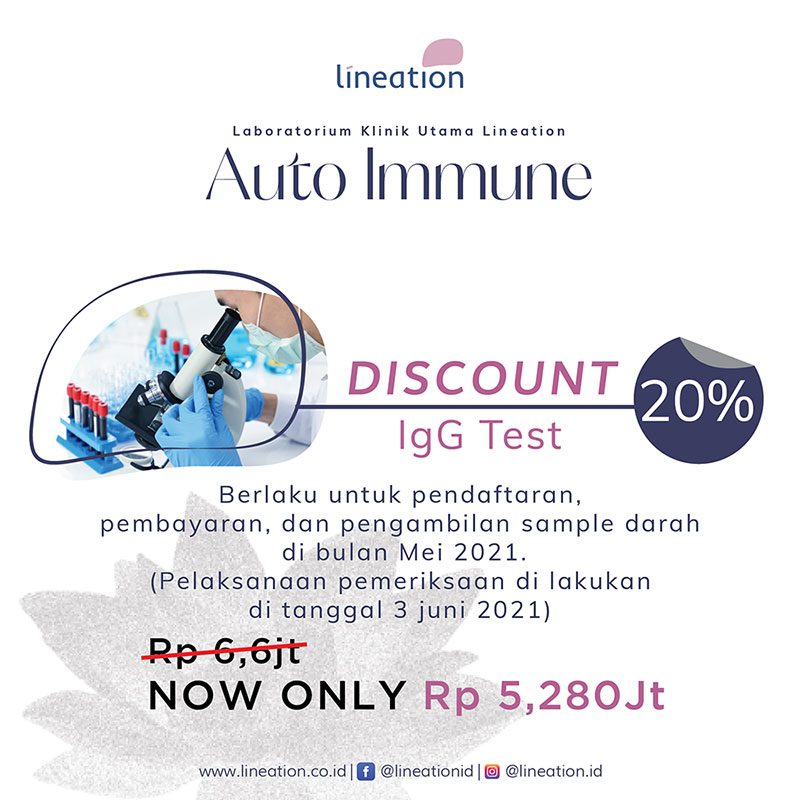 Promo Laboratorium 20% IgG Food