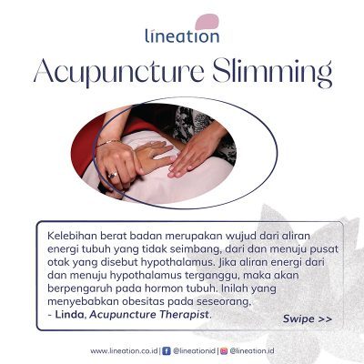 Acupuncture Slimming