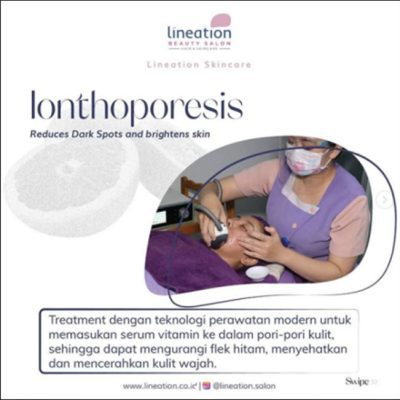 lineation ionthoporesis